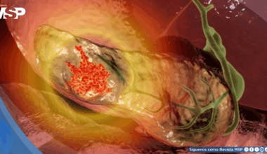 Identifican genes que aumentan el riesgo de cáncer de páncreas y permiten detectar población susceptible