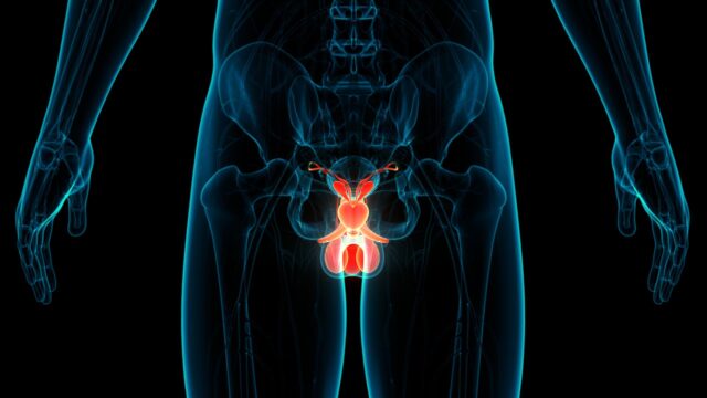 radioligandos-cáncer- próstata-metastásico