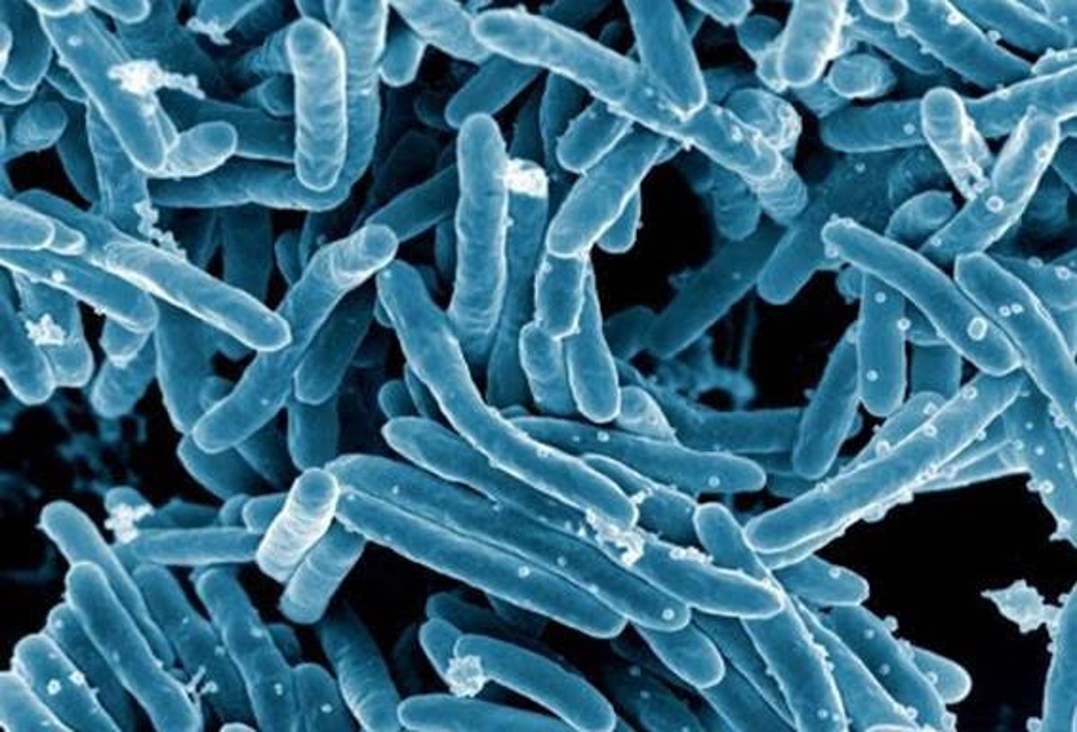 La tuberculosis aprovecha parte del sistema de defensa inmunitaria para causar infección