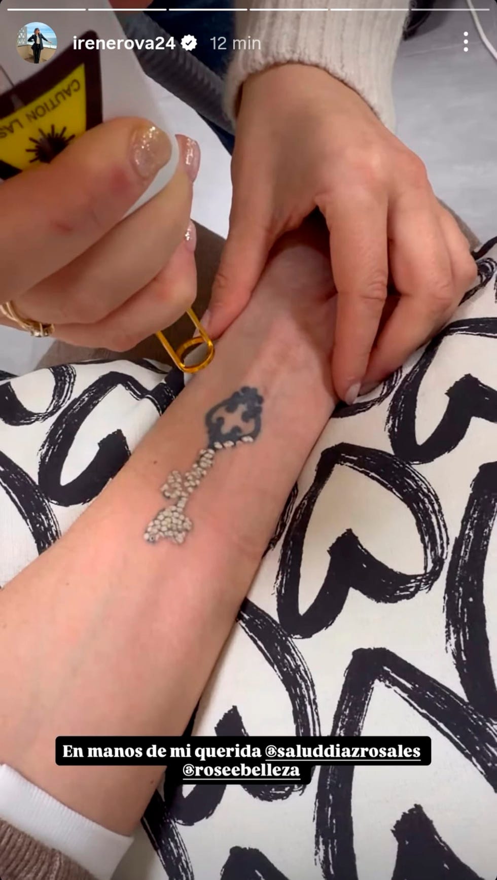 irene rosales se borra el tatuaje que le dedico a kiko rivera, una llave con la palabra 'love'