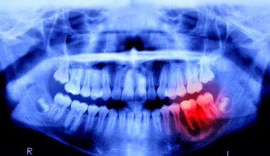 Japón prueba un fármaco que podría regenerar dientes humanos