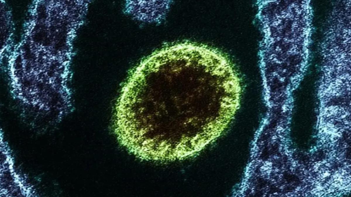 ¿Es posible que el virus Nipah llegue a Europa?