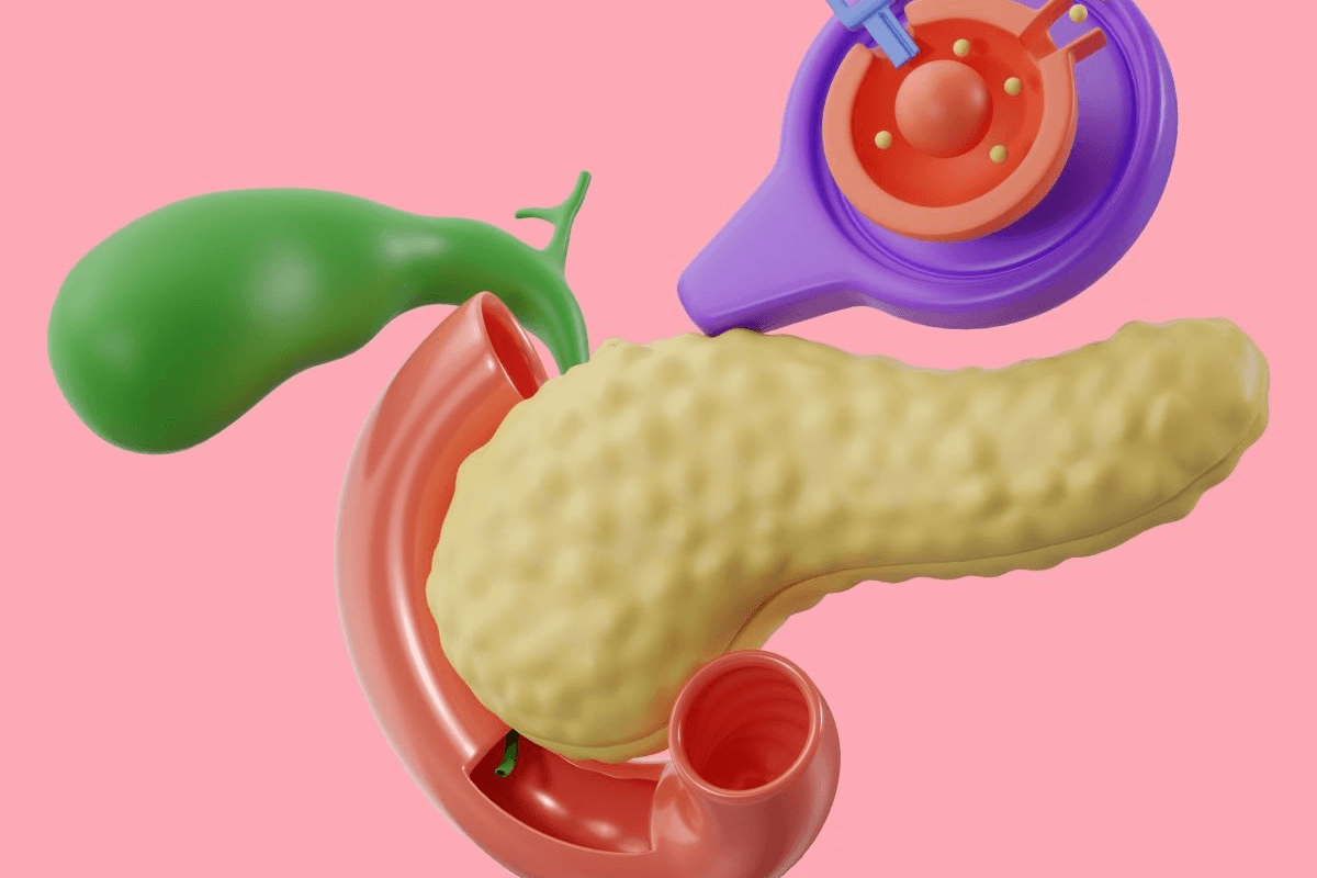 Detectan un factor clave en la secreción anormal de insulina en tumores pancreáticos comunes