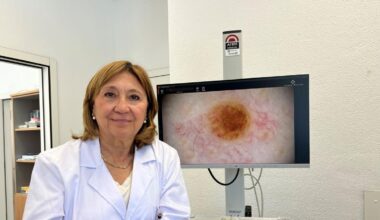 La dermatóloga Dolores Sánchez-Aguilar, delante de una pantalla en la que puede verse un melanoma.