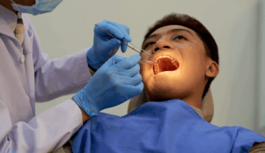 El estrés mecánico exacerba la periodontitis