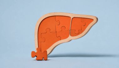 Nuevos datos apuntan a la inmunoterapia como aliada de la embolización en cáncer de hígado