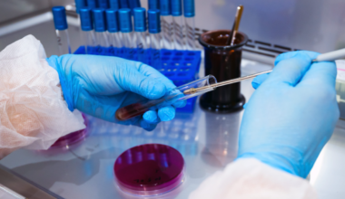 Beneficio clínico sostenido con idursulfasa beta en la mucopolisacaridosis de tipo II
