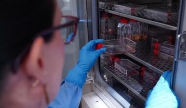 Científicos de Granada diseñan unas 'tijeras moleculares' que frenan la infección del VIH en células de laboratorio