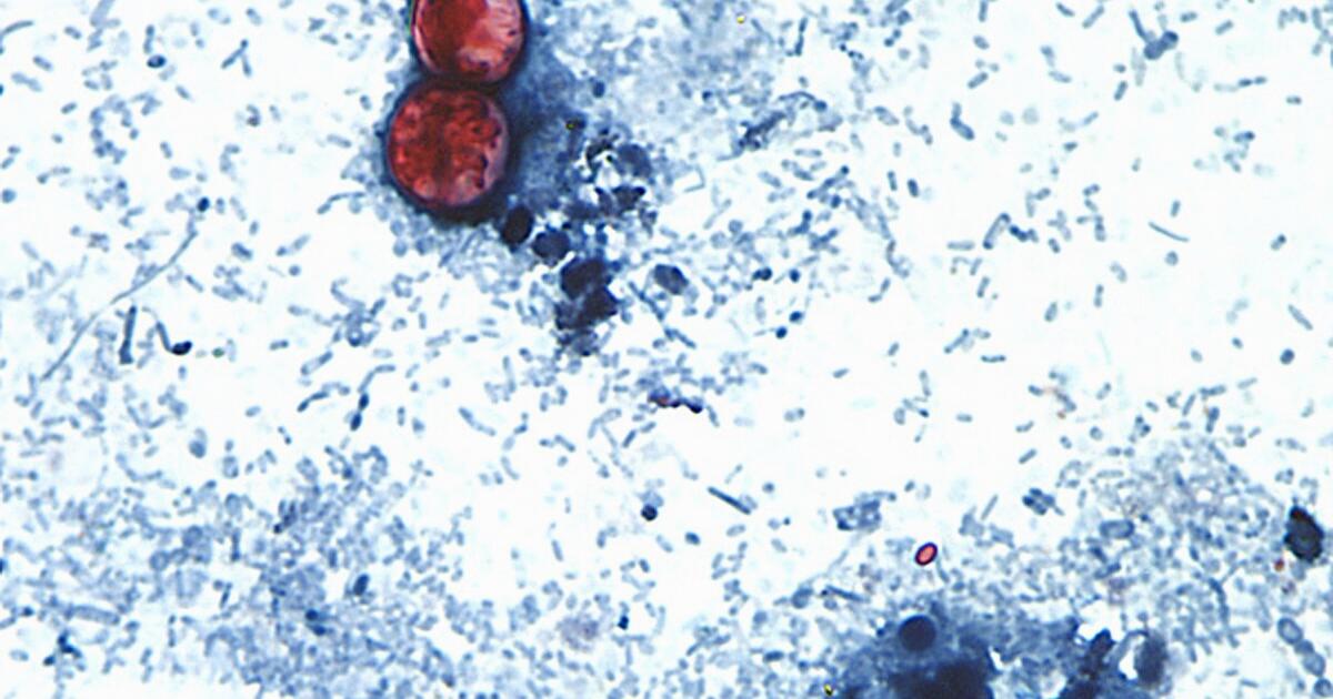 EEUU reporta sus primeras dos muertes por cyclospora, ambas en Michigan