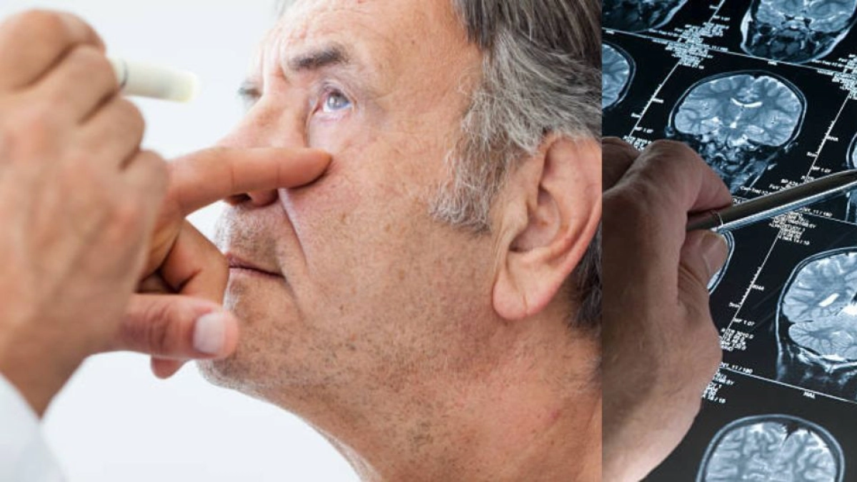 Crean nanopartículas que favorecen la regeneración neuronal y mejoran la memoria en modelos de alzhéimer