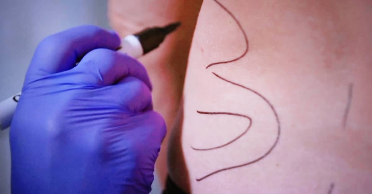 Plastiikkakirurgit tuohtuivat Verohallinnon vaatimuksista: ”Potilaiden valokuvat päätyvät verottajan pöydälle” | Kotimaa