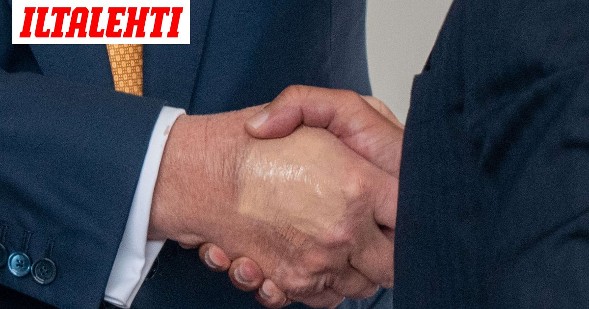 Donald Trumpin käsi herättää huomiota