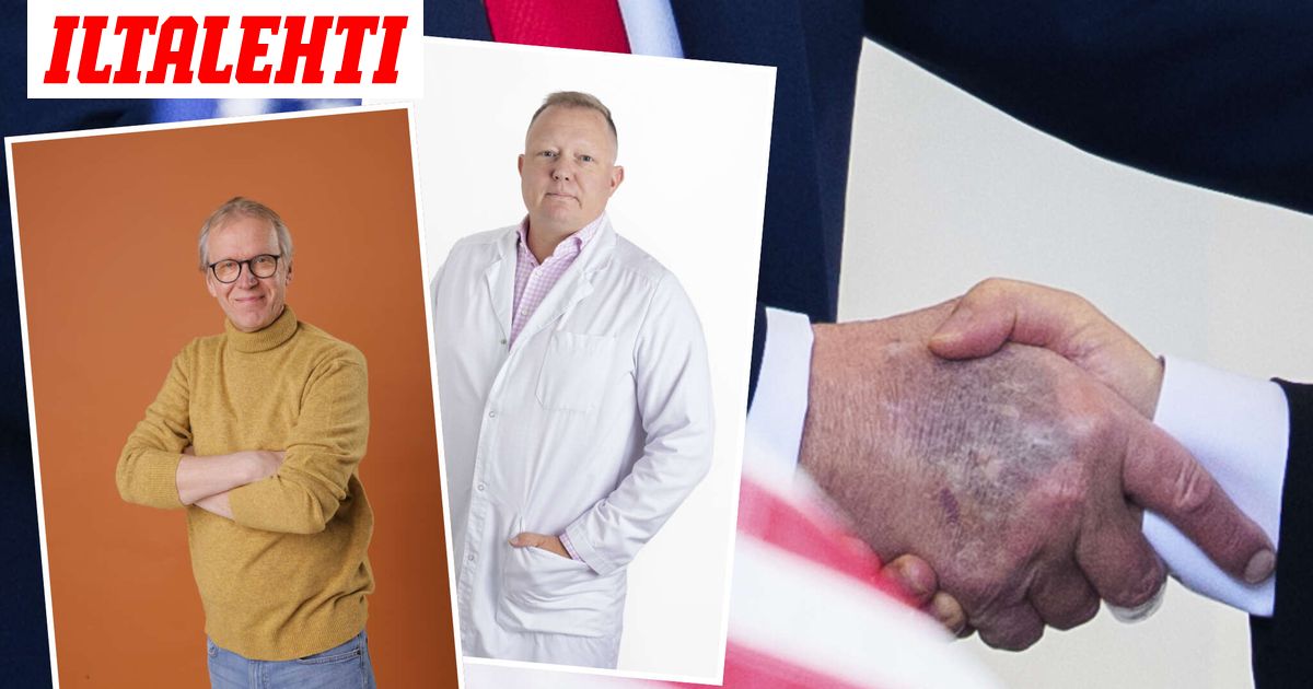 Trumpin mustelmat kiinnittivät huomion – Nyt kommentoivat suomalaiset lääkärit