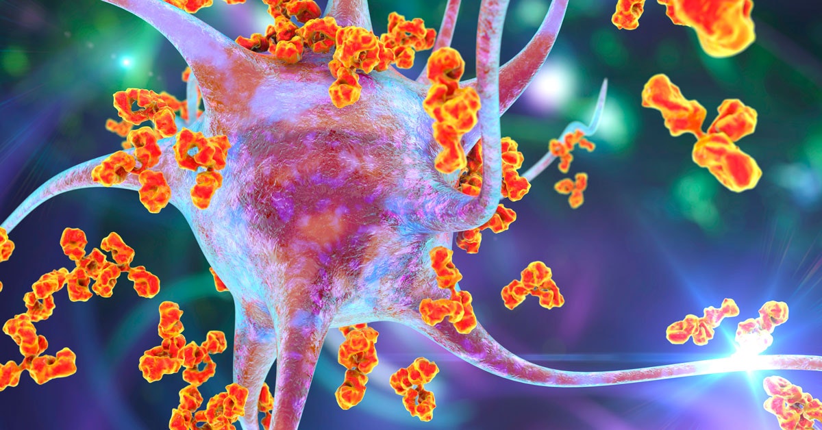 Omega-3-rasvahapot voivat suojata Alzheimerin taudilta
