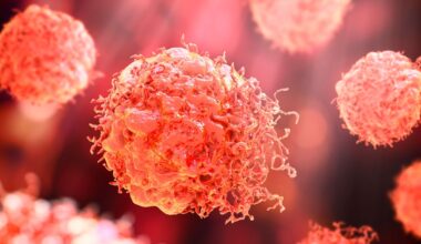 Harmittomana pidetty virus voi aiheuttaa ihosyöpää