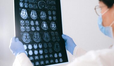 Silmätutkimukset voivat paljastaa Alzheimerin taudin varhaisia merkkejä
