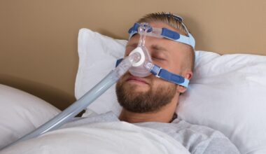 Mies nukkuu selällään CPAP-laitteen nenämaski kasvoillaan.