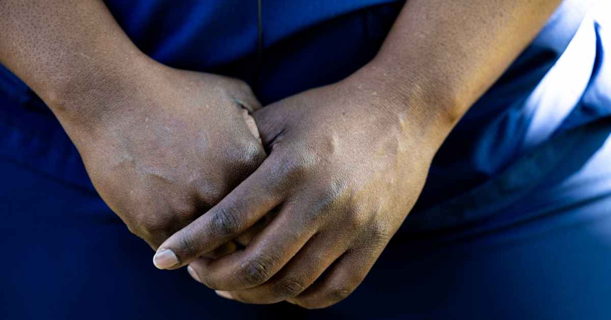 Koeajalla irtisanotut ulkomaiset työntekijät hakevat käräjiltä korvauksia – hyvinvointialue pitää rasismi­väitteitä outoina | Kotimaa