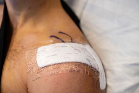 Stagalan olkapää meni sijoiltaan kesken ottelun, ja se ”veivattiin” paikoilleen kamppailun jälkeen pukuhuoneessa,