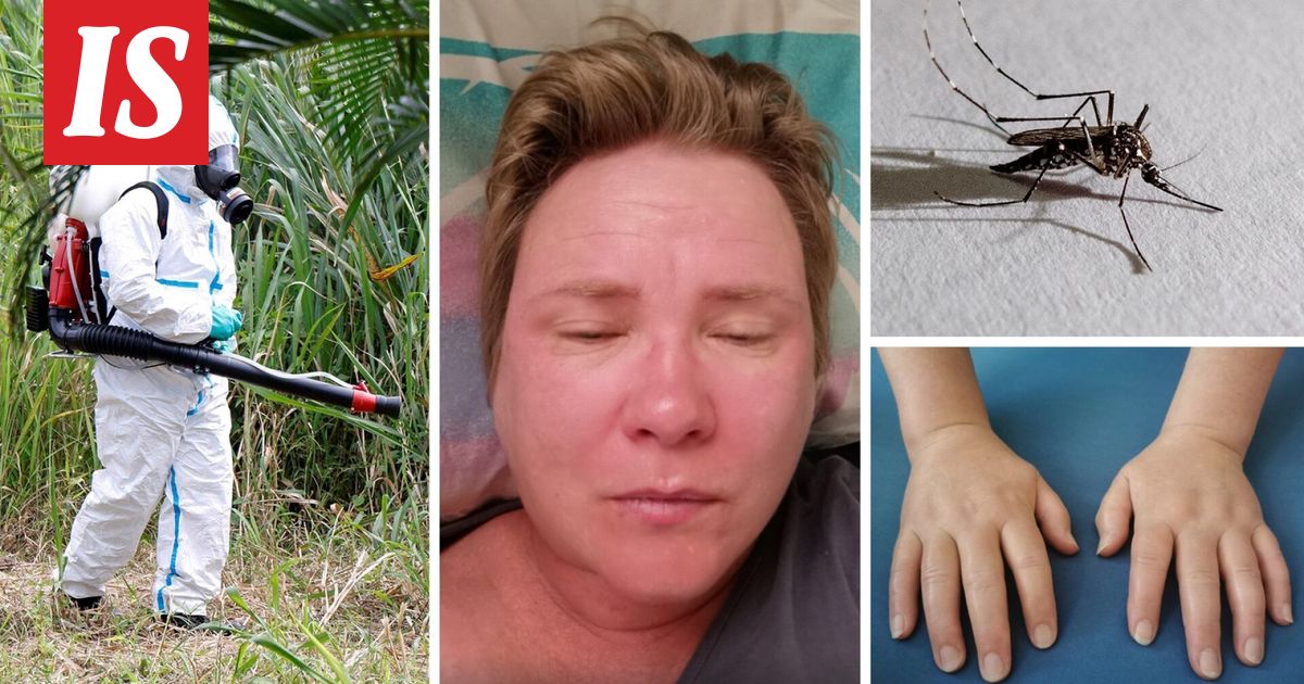 Suomalainen Mervi Huhtilainen kertoo sairastaneensa chikungunyan