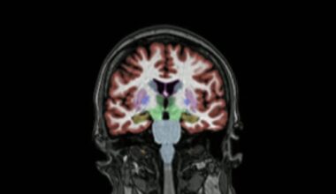 Suomen yleisimmän muistisairauden hoidossa alkaa lokakuussa uusi aika – professori: ”Ihan uuden kategorian lääkkeitä” | Uutiset