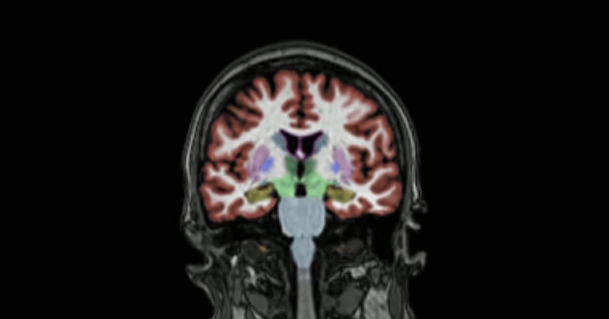 Suomen yleisimmän muistisairauden hoidossa alkaa lokakuussa uusi aika – professori: ”Ihan uuden kategorian lääkkeitä” | Uutiset