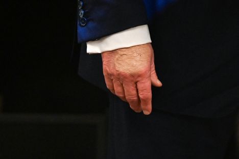 Trumpin kämmenselkään on selvästi käytetty jonkinlaista meikkituotetta.