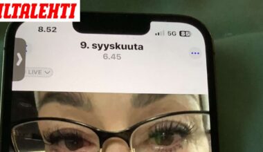 Vantaalainen Eha, 52, vitsaili olevansa botox-mimmi – Kolme päivää myöhemmin tuli ambulanssi