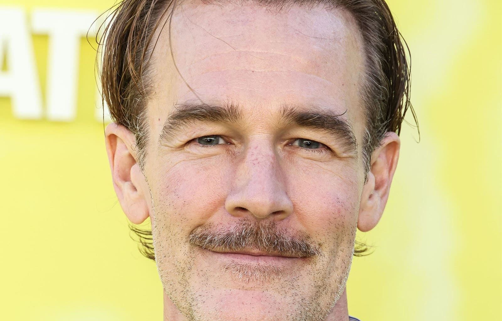 Syöpätaistelua käyvä James Van Der Beek joutui jäämään pois Dawson’s Creek -jälleennäkemisestä – Vaimo ja lapset saapuivat edustamaan