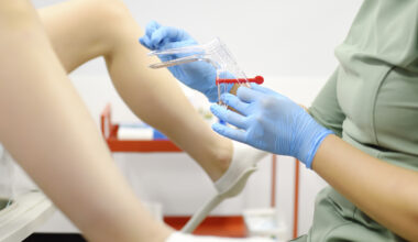 Miten usein gynekologilla pitäisi käydä? Tämä on nykyinen käsitys
