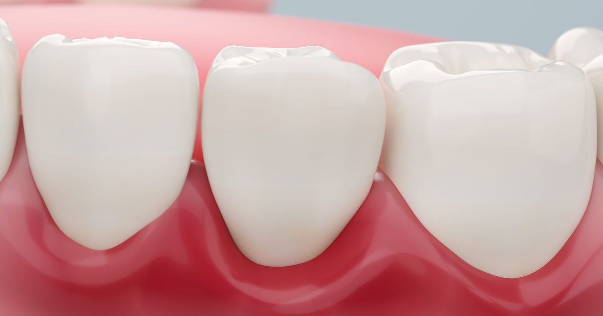 Välimeren ruokavalio voi vähentää iensairauksien riskiä