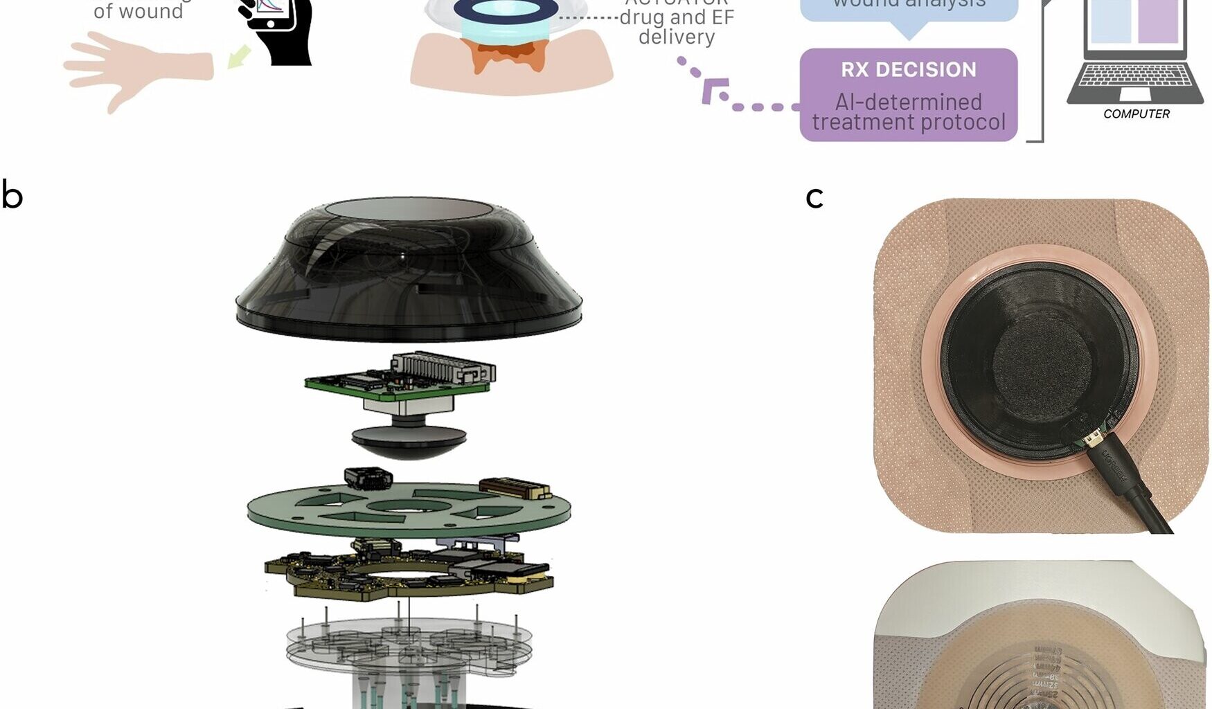 Tekoälyllä hyödyntävä "laastari" parantaa haavat huomattavasti tavanomaista nopeammin