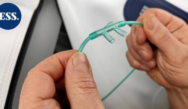 Outoja hengitysvajauksia ja pysyviä lonkkamurtumia – kaksi hyvinvointialuetta väittää löytäneensä virheitä, jotka voivat vääristää rahoitusta jopa sadoilla miljoonilla | Uutissuomalainen