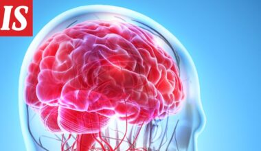 Epäterveellinen ruokavalio voi nopeuttaa muistisairauden ilmaantumista