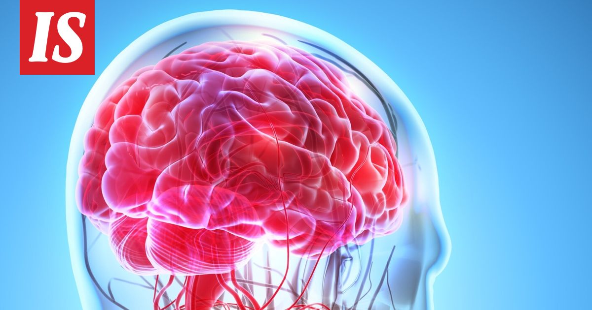 Epäterveellinen ruokavalio voi nopeuttaa muistisairauden ilmaantumista