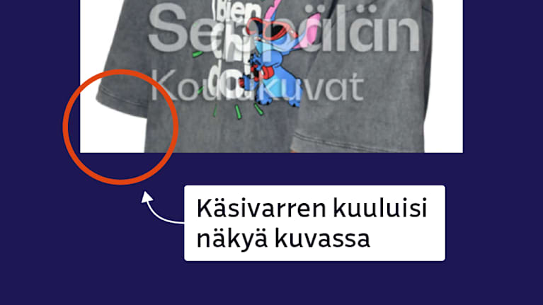 Koulukuvasta on rajattu pojan kasvot pois. Punainen ympyrä näyttää puuttuvan käsivarren kohdan.