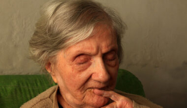 Läpimurto Alzheimerin hoidossa? Nanoteknologia käänsi taudin kulun hiirillä