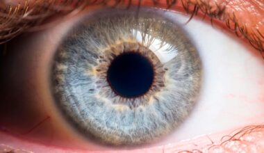 ADHD-henkilöt ovat usein tavallista luovempia