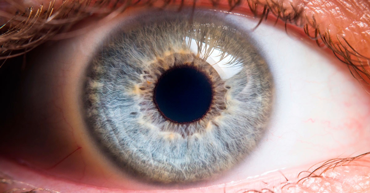 ADHD-henkilöt ovat usein tavallista luovempia