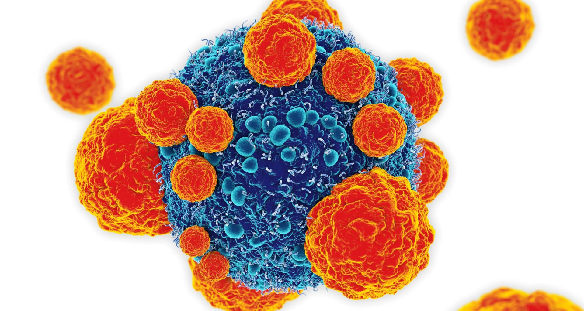 Tutkijat löysivät biologisen kytkimen, joka saa kehon hyökkäämään syöpäsoluja vastaan