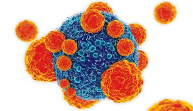 Tutkijat löysivät biologisen kytkimen, joka saa kehon hyökkäämään syöpäsoluja vastaan