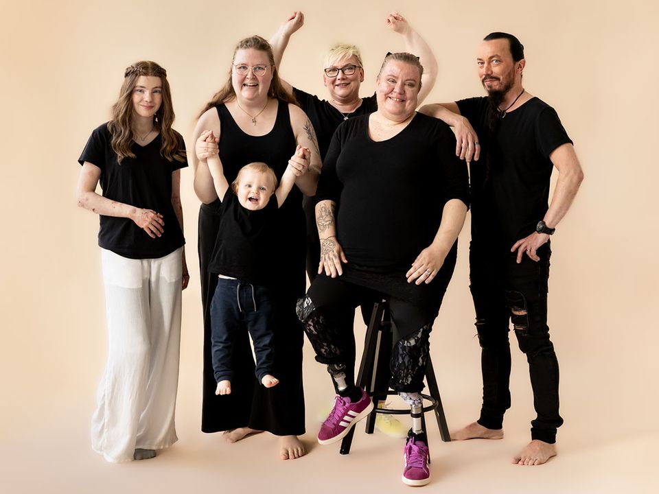 Kyselytutkimus: Ihorauhaa rikotaan hälyttävän usein | Allergia-, Iho