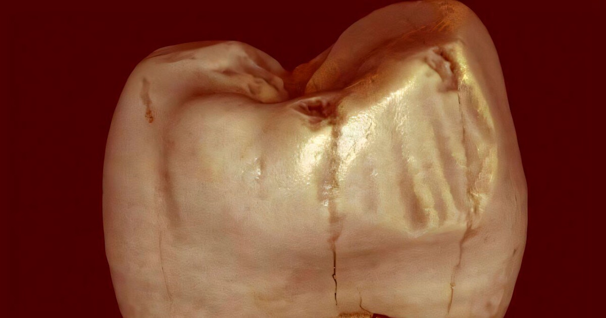 Muinaisihmisten hampaiden urat saivat uuden selityksen