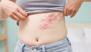 Vyöruusurokote voi jopa pelastaa henkesi, tutkimus esittää