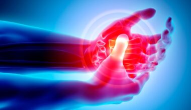 Uusi menetelmä havaitsee nivelveuman vuosia ennen kipuja