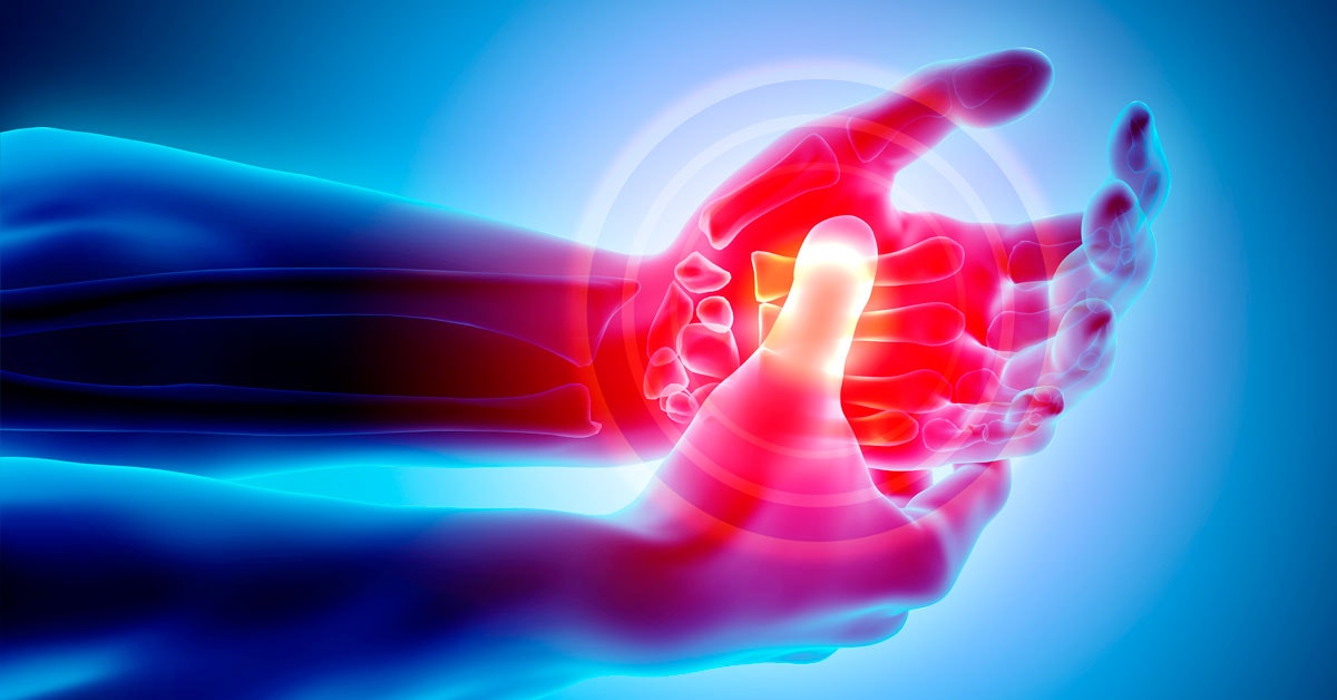 Uusi menetelmä havaitsee nivelveuman vuosia ennen kipuja