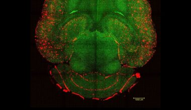 Ensimmäinen kerta: Tutkijat onnistuivat kääntämään Alzheimerin taudin kulun hiirillä uudella menetelmällä
