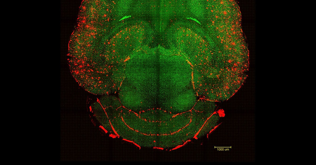 Ensimmäinen kerta: Tutkijat onnistuivat kääntämään Alzheimerin taudin kulun hiirillä uudella menetelmällä