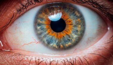 Verkkokalvon verisuonet kielivät terveydestä | tieku.fi