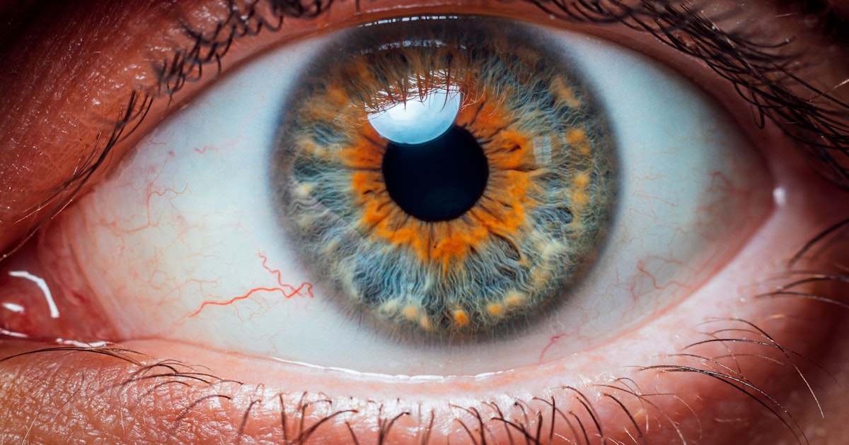 Verkkokalvon verisuonet kielivät terveydestä | tieku.fi